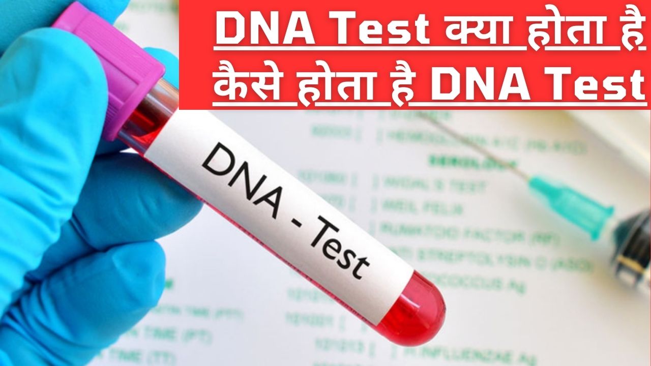 dna test